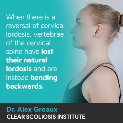 What Is Reversal of Cervical Lordosis? Treatment Options?